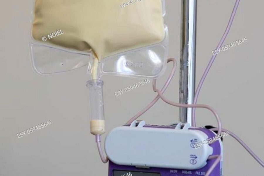 The tube feed on the IV pole with the feeding pump