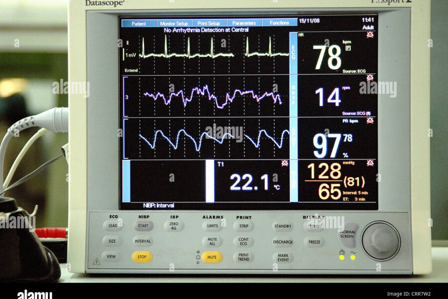 Abnormal Heart Rhythms and Lost Dads